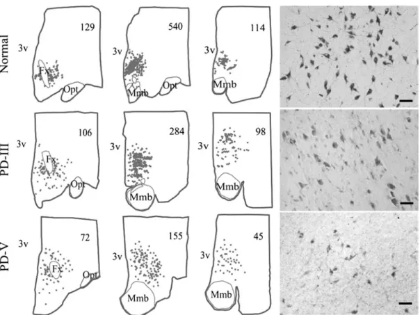 Fig.  2 Distribution  of  hcrt  cells  in  normal  subjects  and  across  the  stages  of  Parkinson’s  disease  (PD)
