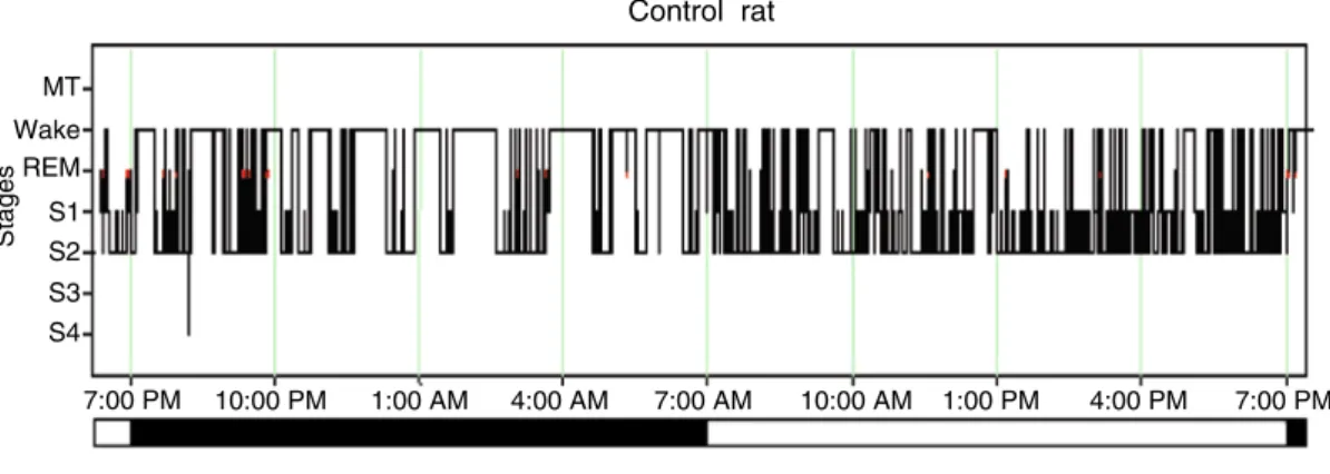 Fig.  4  Rat  hypnogram  observed  1  week  after  bilateral  lesioning  of  dopaminergic  ventral  tegmental  pathways  made  by  direct  injection  of  the  dopaminergic  toxin  6-hydroxydopamine into the nucleus accumbens [29]