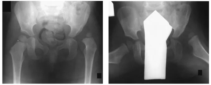 Figure 27A Figure 27B
