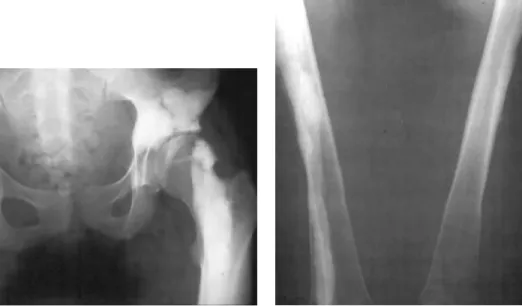 Figure 32A Figure 32B