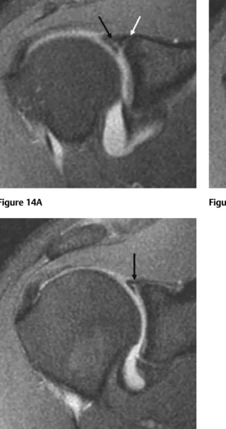 Figure 14A Figure 14B