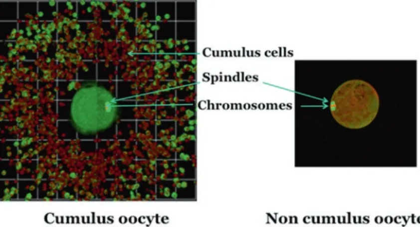 Fig. 2 Images of immunofluorescence staining of oocytes with and without  cumulus cells