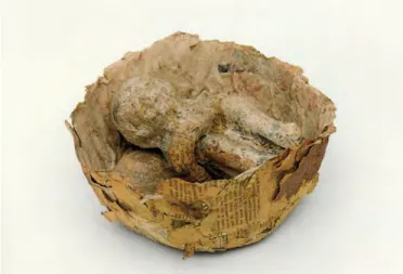 Figure 15   Fetus