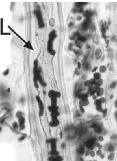 Figure 1.4 Monadenium ellenbeckii (Euphorbiaceae). Elongated I-shaped starch grains in laticifer (L); ovoid starch grains present in adjacent parenchyma cells