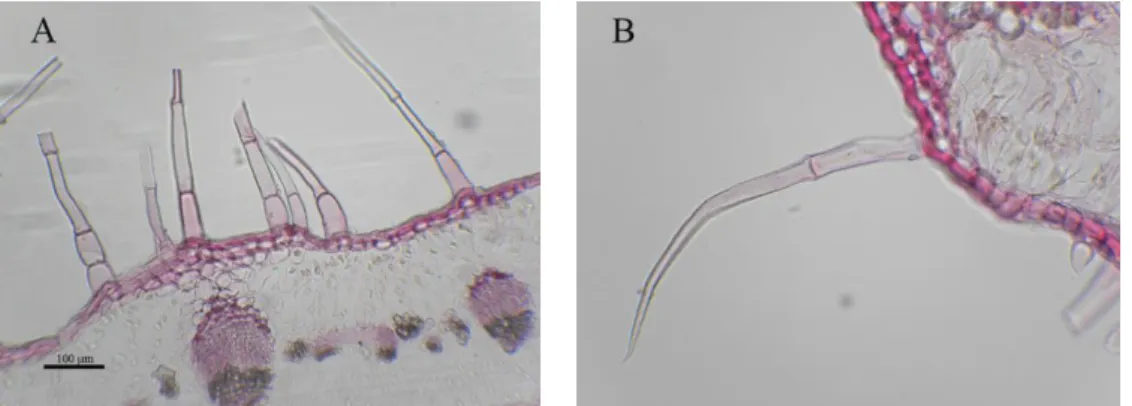 Fig. 30. Non-glandular trichome of leaves in different populations. subsp. scoparia: A, Hardang; B, Martaeh-e- Chah  Neghahdar populations
