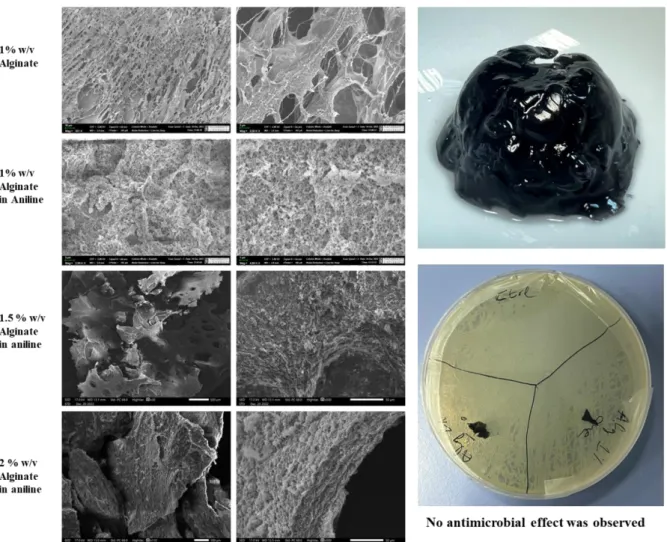 Figure 4.1.2. SEM images of freeze-dried hydrogels, the general image of hydrogel and its  antibacterial test on Escherichia coli