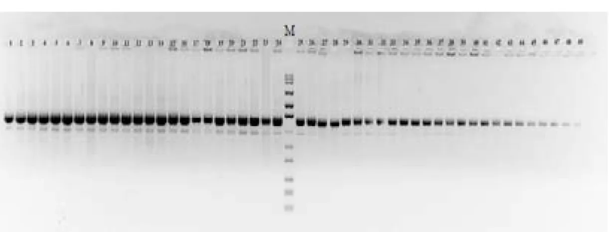 Figure 2 – Electrophoresis of pooled samples. These products were produced   in multiplexed PCR with three primer-sets shown in Table 1.