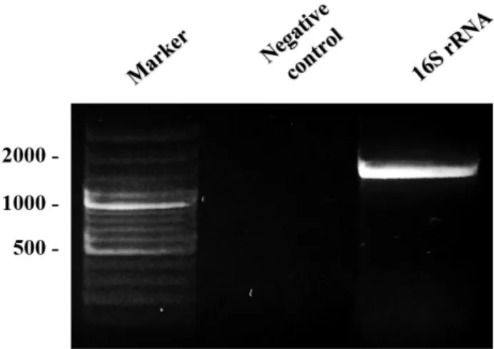 Figure 1 – Agarose gel electrophoresis of PCR product of the  16S rRNA gene of isolate P