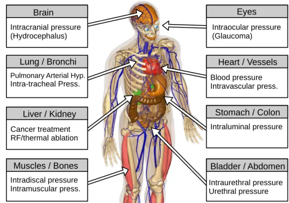 Figure 1. Body parts with pressure measurements and the relevant underlying physiological/pathophysiological condition associated with each organ/tissue (created in bodyparts3d [13,14]).