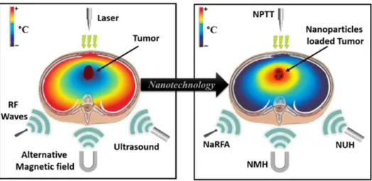 Figure 3. Thermal hypothermia of  a tumor using nanoparticles enclosed inside of it absorbing the  energy  coming  from  different  heat  sources