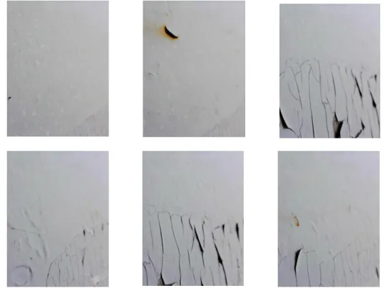 Figure 4.9: Images taken by the endoscope camera while the robot is climbing