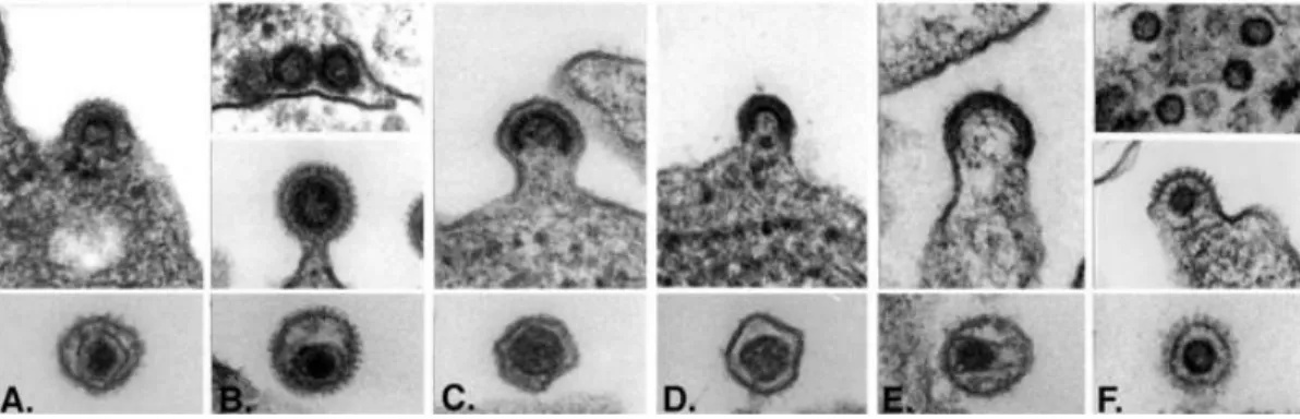 Figure 2: Different morphologies of retroviruses. 