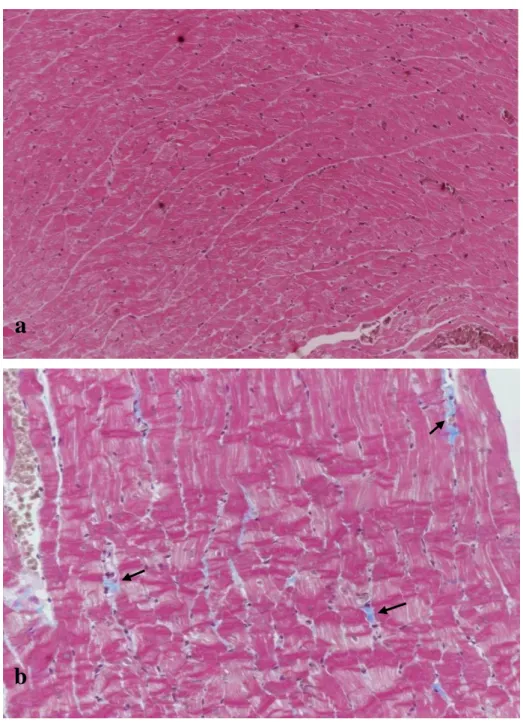 Figure  27:  Masson  trichrome  staining  for  collagen  fiber  in  the  myocardium  (a)  normal  untreated rats (b) normal treated rats