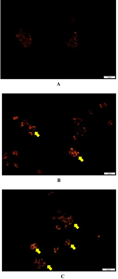 Figure 6: Autolysosomes visualized at 20X magnification after treating with Safranal IC25  and  IC50
