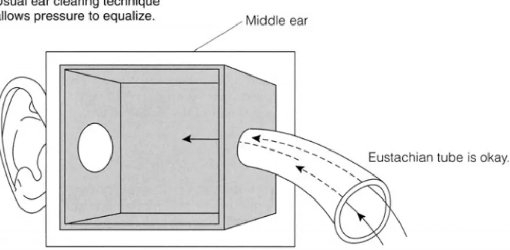 Figure 5-7  Common methods of clearing an ear block will not work if the block is the  result of the mucous membranes being swollen from a cold or hay fever.