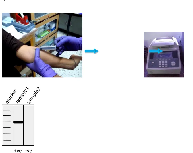 Figure 16.2: Use of PCR in HIV-1 test. The blood from patient is drawn and the viral DNA is amplied using PCR