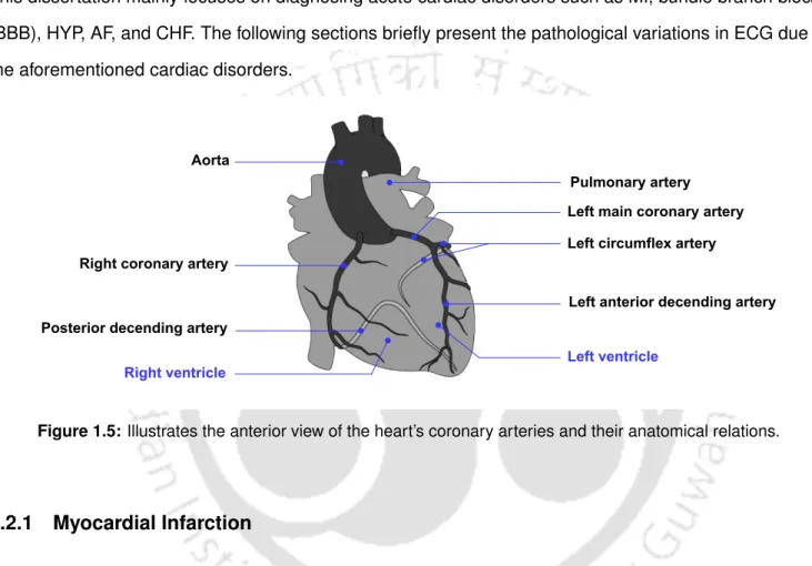 Figure 1.5: Illustrates the anterior view of the heart’s coronary arteries and their anatomical relations.