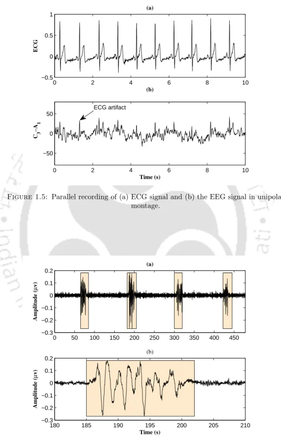 Figure 1.5: Parallel recording of (a) ECG signal and (b) the EEG signal in unipolar montage.
