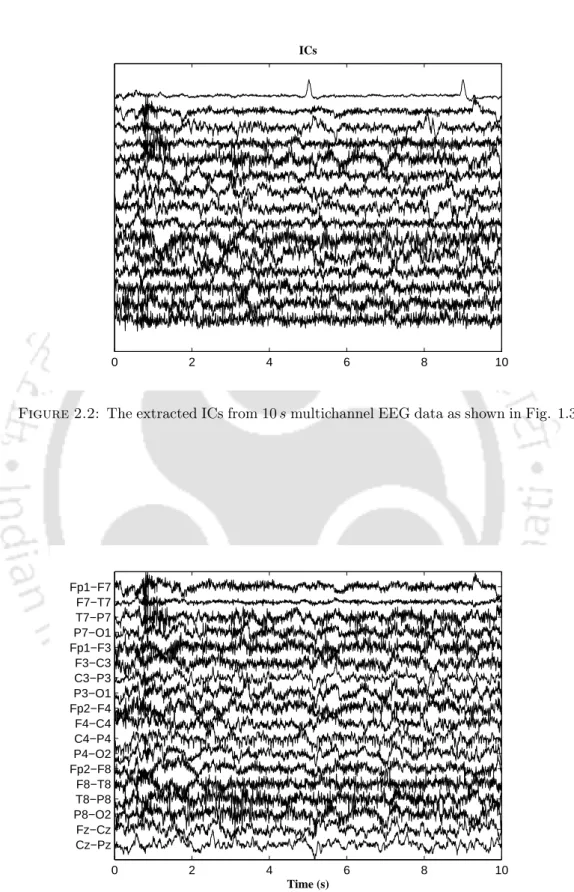 Figure 2.2: The extracted ICs from 10 s multichannel EEG data as shown in Fig. 1.3.