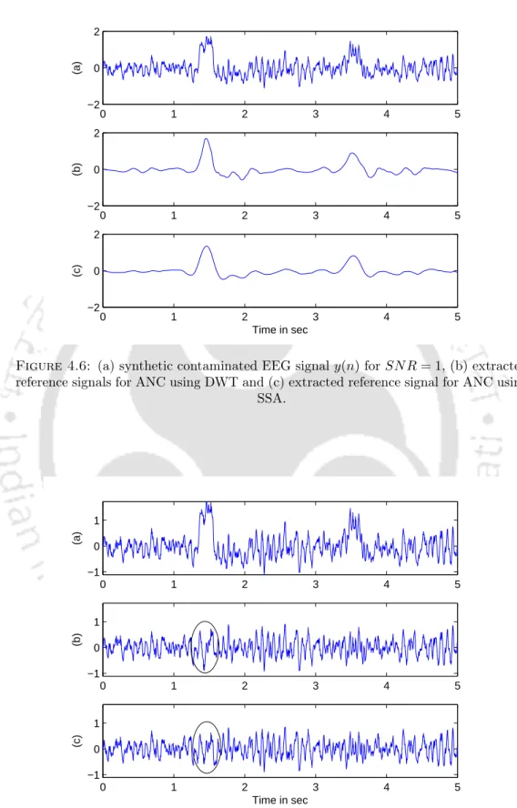 Figure 4.6: (a) synthetic contaminated EEG signal y(n) for SN R = 1, (b) extracted reference signals for ANC using DWT and (c) extracted reference signal for ANC using
