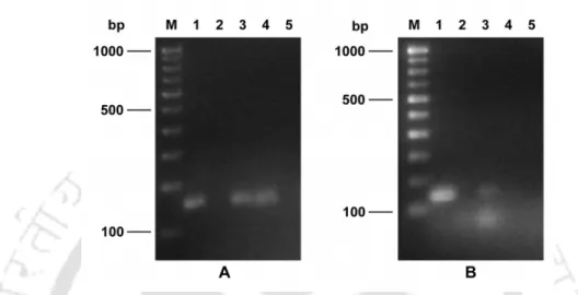 Figure 2.5 PCR-based direct detection of bacteriocin encoding genes of LAB in fermented cucumber  sample after (A) 36 h and (B) 72 h of fermentation