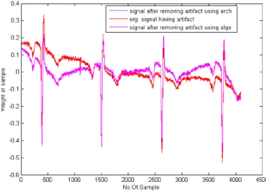 Fig. 3. Comparision among the signal having artifact(red),signal af-ter removing artifact using  algorithm(magenta),signal after removing artifact using 