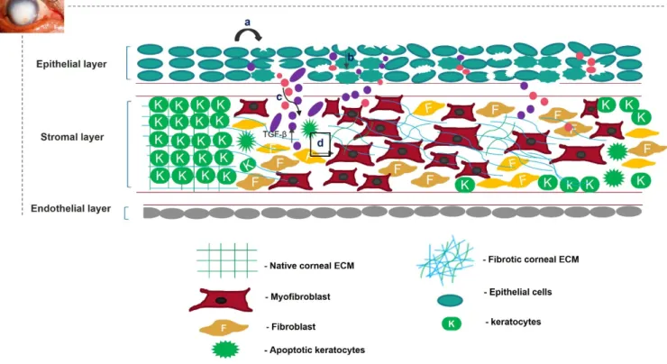 Figure 1. Overview of corneal wound-healing process and scar formation. After an ocular wound,  specifically epithelial wounding, (a) the epithelial cells undergo apoptosis, (b) and epithelial cell  markers are lost because of corneal epithelial injury, tr
