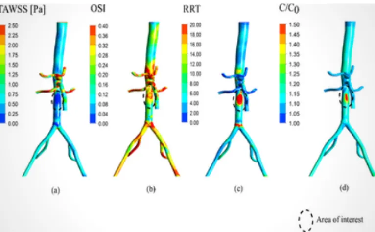 Fig. 3: CFD predictions of locations of atherosclerosis using WSS-based indicators and LDL concentration.