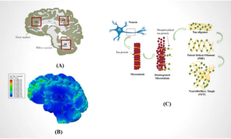 Fig. 1: (A) Segmented white-grey matter and identification of critical strain locations (B) Localized strain in brain sulci (C) Brain strain-induced tau protein aggregation and