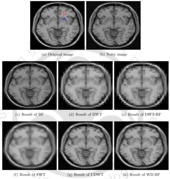 Figure 5.9: Denoising results of simulated T1 weighted axial MRI corrupted by 5% noise level