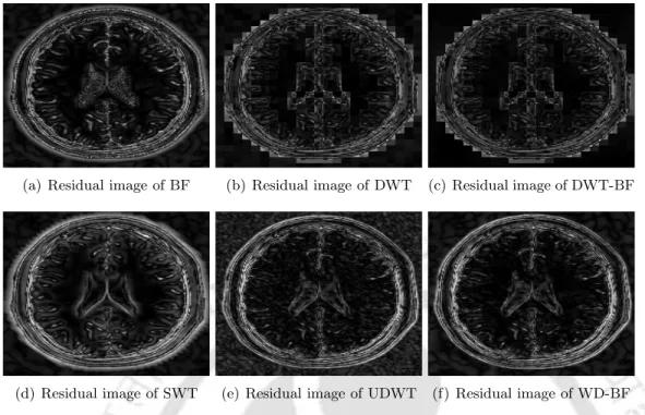 Figure 5.13: Illustration of the extent of over-smoothing in the T2 weighted simulated image corrupted by 9% noise.