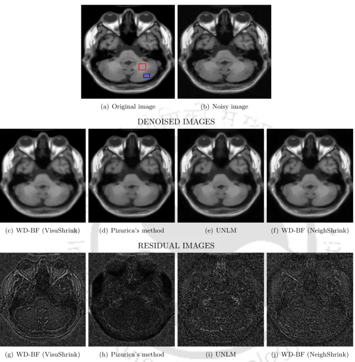 Figure 6.5: Denoising results of simulated T1 weighted axial image corrupted by 5% noise level