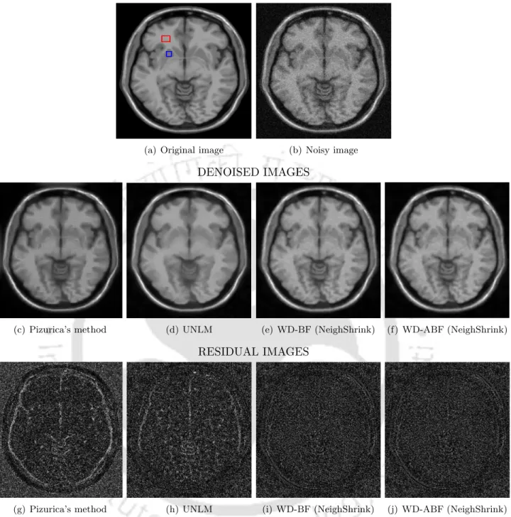 Figure 7.3: Comparison of the denoising results of a simulated T1 weighted axial image corrupted by 5%