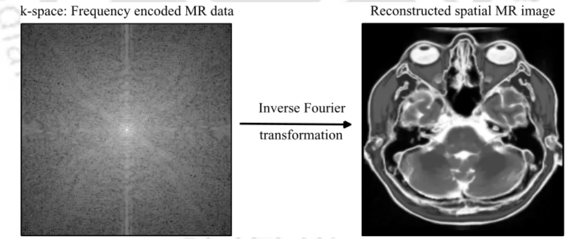 Figure 2.7: Schematic representation of the MR image reconstructed from the k-space data using 2D inverse fast Fourier transform.