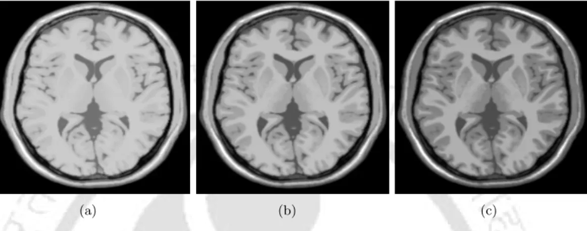 Figure 2.8: Effects of TR and TE on the contrast of T1 weighted brain MR images. Illustration using the images acquired using spin echo sequence with the parameters (a) TR=1100 ms,TE=10 ms (b) TR=650 ms,TE=10 ms