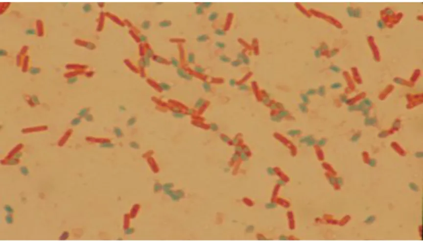Fig.     Bacillus cereus spores with green colour stain  Common sources of infection include:  