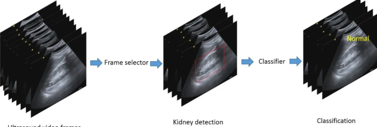 Figure 1.2: Abstract level representation of proposed algorithm for diagnosing kidney.