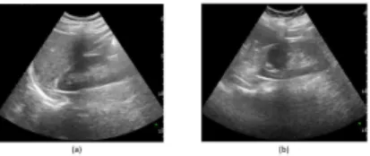 Fig. 4.1 shows the FPGA based CAD implementation of the classifier to determine the abnormality of organ [22] in ultrasound images