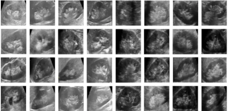 Figure 5.9: Some of the Kidney Images used in training Viola Jones algorithm.