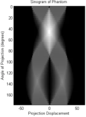 Figure 1.3: Sinogram(density plot of the X-ray transform)