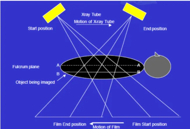 Figure 1.1: Old tomography
