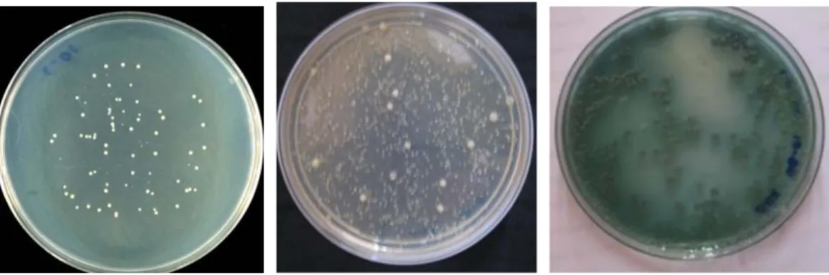 Figure  7 :  Spread plate culture of dental plaque bacteria  