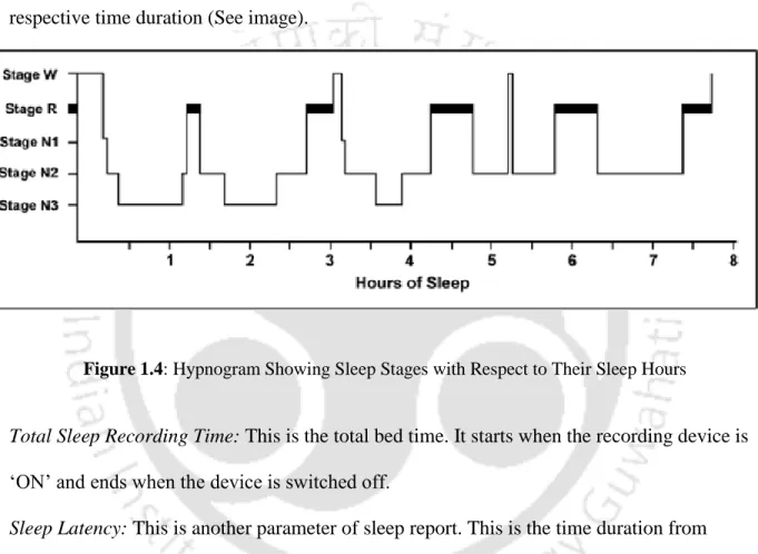 Figure 1.4: Hypnogram Showing Sleep Stages with Respect to Their Sleep Hours