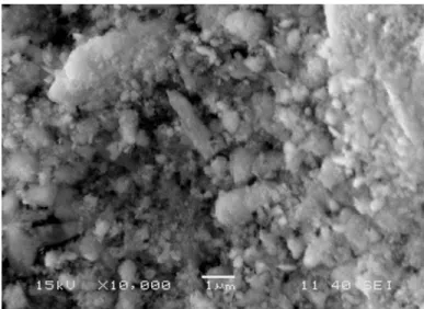 Fig. 4.6. (b)  SEM micrograph of NRM. 