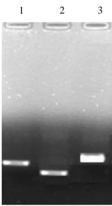 Figure 7. Gel picture showing Gene specific PCR amplification 
