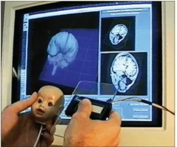 Figure 2-2 Shows a user selected a cutting plane of a mannequin head with the  props interface showing the corresponding MRI image cuts part of preoperative 