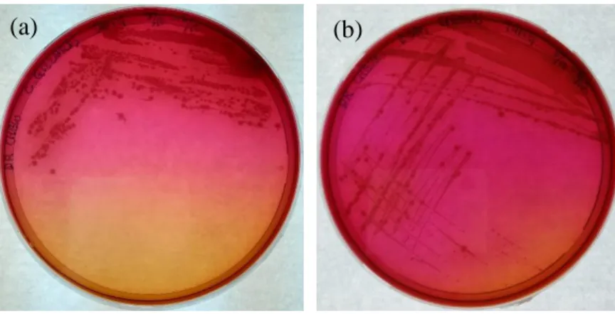Figure 4.2: Bacterial culture inoculated from (a) chicken gizzards and (b) bean  sprouts on Listeria selective PALCAM agar