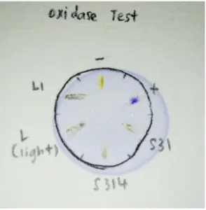 Figure 4.5: Oxidase test results. P. aeruginosa was used as the positive control  (+) and it gave deep purple-blue coloration