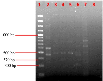 Figure 4.10: Gel image for detection of  prs  gene under visualization of Bio- Bio-Rad Gel Imaging System