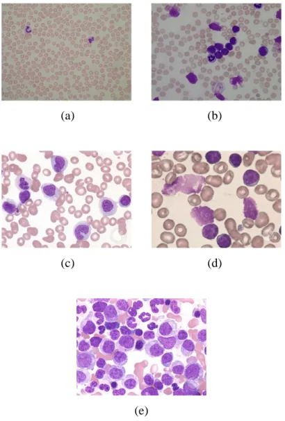 Figure 2.2: (a) Blood Smears of Healthy Blood Cells (Scotti, Labati and Piuri, 2011). 